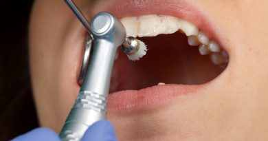 Как проводят профессиональную чистку зубов?